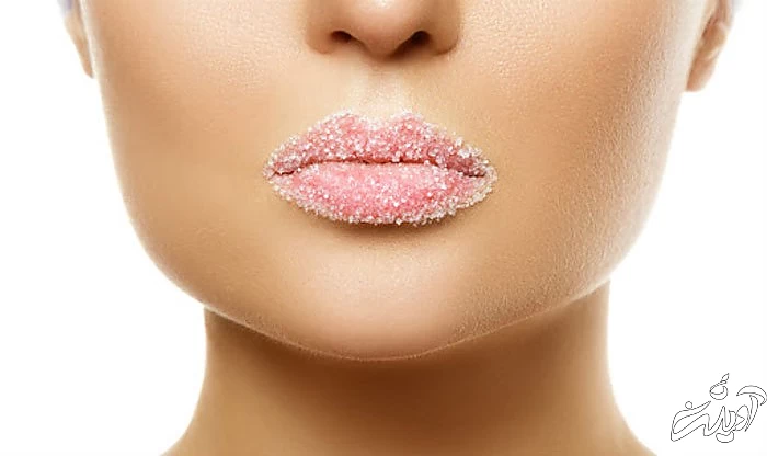 ۵ درمان خانگی برای لبهای ترک خورده ۵ درمان خانگی برای لبهای ترک خورده